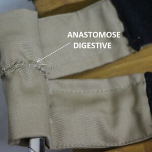 anastomose