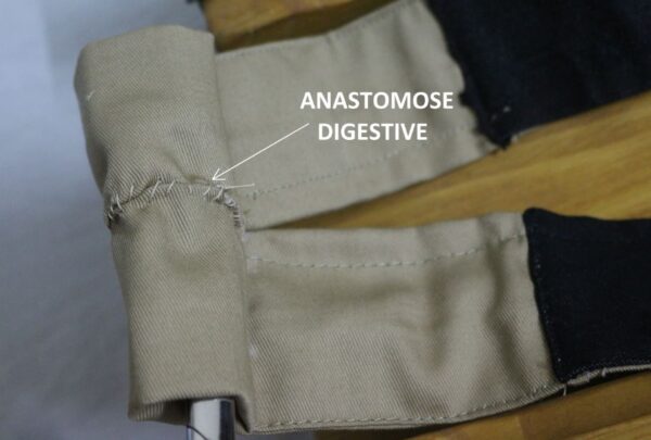 anastomose anastomose