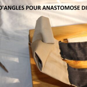 Capture point d’angle pour anastomose digestive