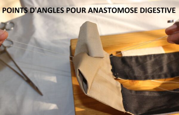 Capture point d’angle pour anastomose digestive Capture point d’angle pour anastomose digestive